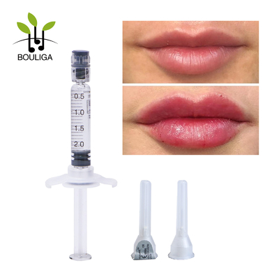 Заполнитель 2ml OdM вводимый Hyaluronic кисловочный дермальный для увеличения губы
