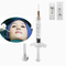 Корейский заполнитель губы 1ml Hyaluronic кисловочный дермальный для линий марионетки